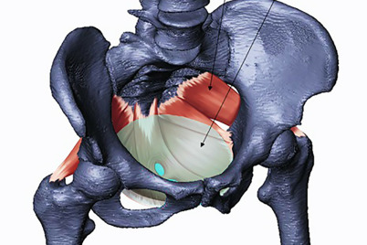 Beckenboden mitverantwortlich für die Evolution der menschlichen Geburtsprobleme